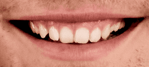 NewWebsite_Testimonial_after_PHIL_1