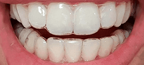 NewWebsite_Testimonial_after_SIMIN_1