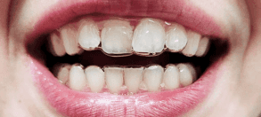 NewWebsite_Testimonial_before_INEZ_1
