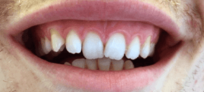 NewWebsite_Testimonial_before_PHIL_1