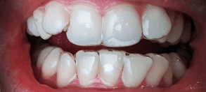 NewWebsite_Testimonial_before_SIMIN_1